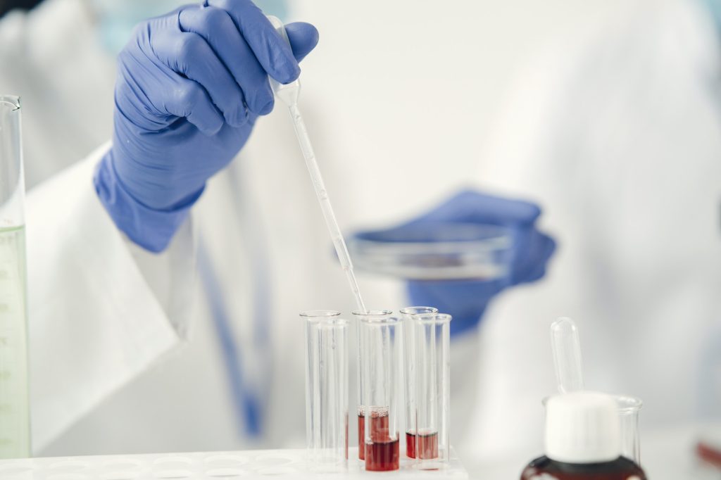 Laboratory worker studying blood samples to detect pathologies
